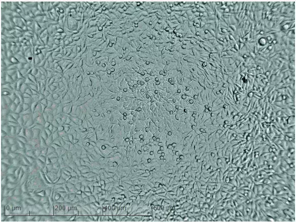 Mikroskopiebild niedrige Zelldichte nach 120 Stunden