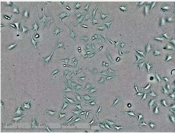 Mikroskopiebild niedrige Zelldichte nach 24 Stunden