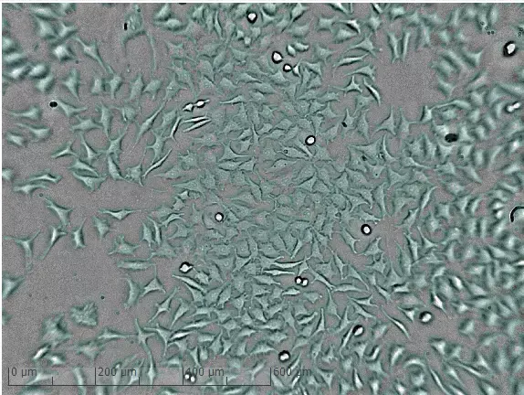 Mikroskopiebild niedrige Zelldichte nach 90 Stunden