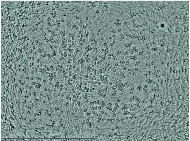 Mikroskopiebild hohe Zelldichte nach 90 Stunden