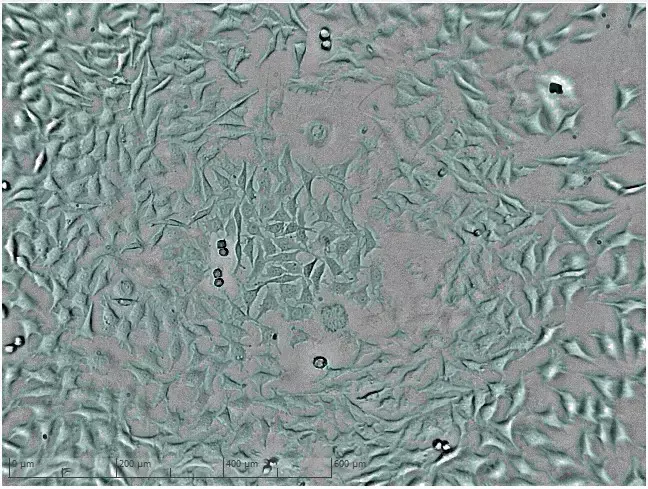 Mikroskopiebild hohe Zelldichte nach 36 Stunden