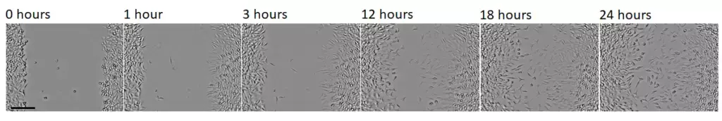 Prozess des Gap-Closures