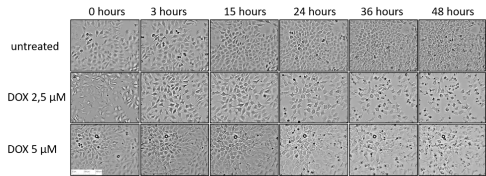 DOX-Effekte auf die Zellmorphologie